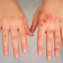 Pharmacist assessing a patient