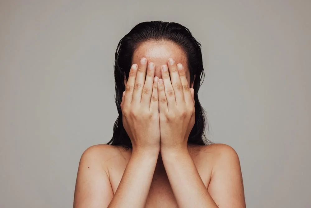 Facial hair (hirsutism) treatment
